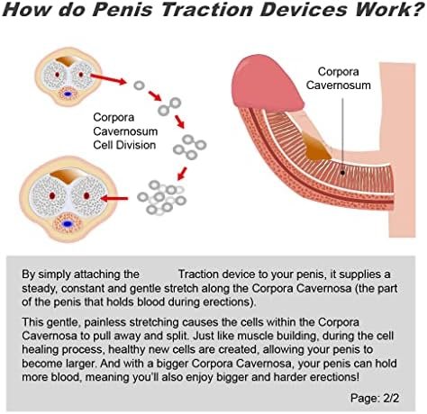 Penis Extender Penis Stretcher Enlarge Device Male Penis Length Enlargement Kit Length & Angle Adjustable Penis Training Device - Image 3