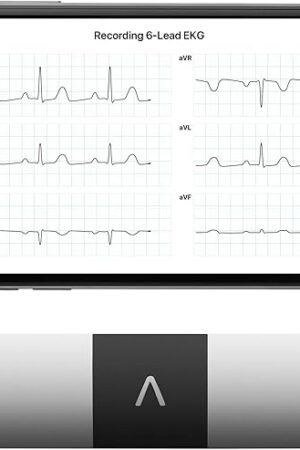 KardiaMobile 6L | 6-Lead Personal EKG Monitor | Check Your Heart at Home | Advanced Detection of AFib and Other Arrhythmias | Doctor-Recommended Device | Fast Results on Your Phone | FSA/HSA Eligible