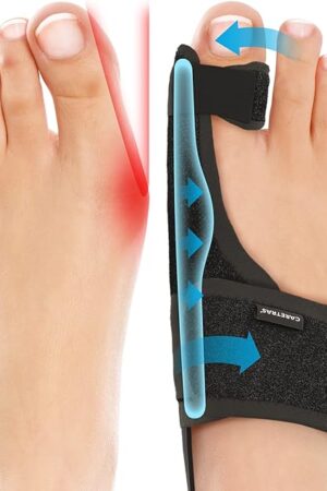 Caretras 2-Pack Bunion Corrector for Women & Men, Orthopedic Bunion Splint for Hallux Valgus Pain Relief, Big Toe Separator, Adjustable Day/Night Support, Comfortable Hammer Toe Straightener