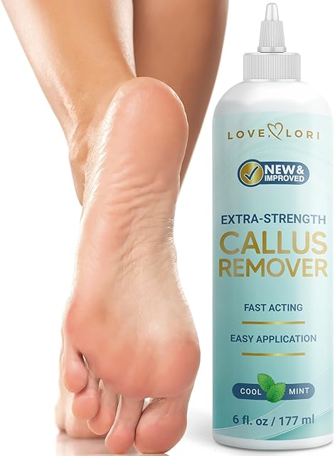 Callus Remover for Feet (Extra Strength) Foot Callus Remover Gel - Feet Scrubber, Pedicure Spa Tools, 6oz